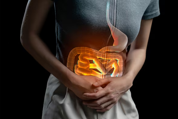 Functional Bowel Disorders or Disorders of Gut Brain Interactions